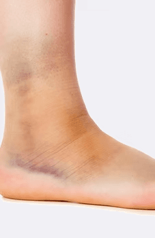 Faster recovery from acute injury and repetitive stress